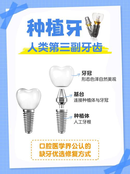 抖友晒半口全口种植牙6年后100字真实感受：实用建议大揭秘