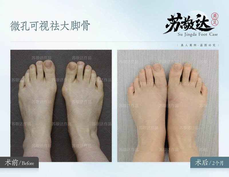苏敬达联系方式汇总，2026年任职北京圣嘉新，可电话网上约大脚骨矫正 