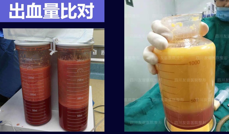 2. 7项国家专利技术的特色修复