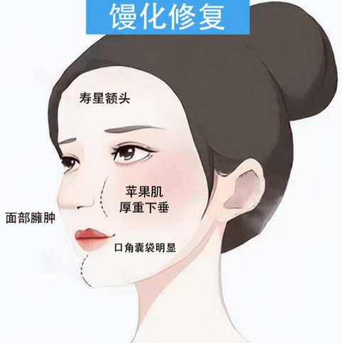 2. 价格透明，杜绝隐形消费