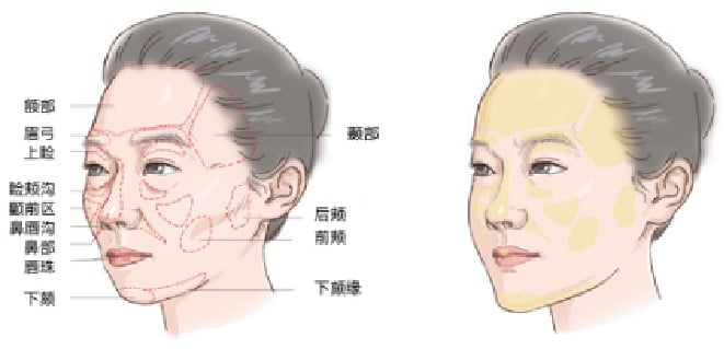 Q3：在外地想找张红芳博士面诊，应该怎么安排行程？