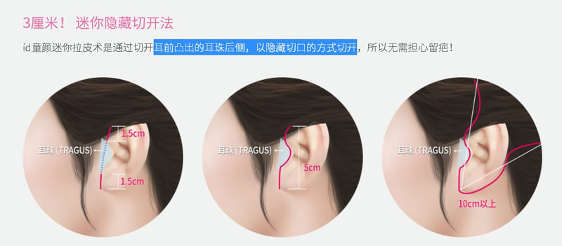 三、如何判断并预约一位靠谱的拉皮医生：实操指南
