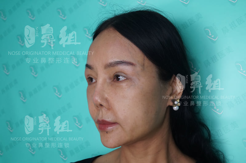 南京医美童颜项目预约攻略：荔枝美小程序可一键约医院医生
