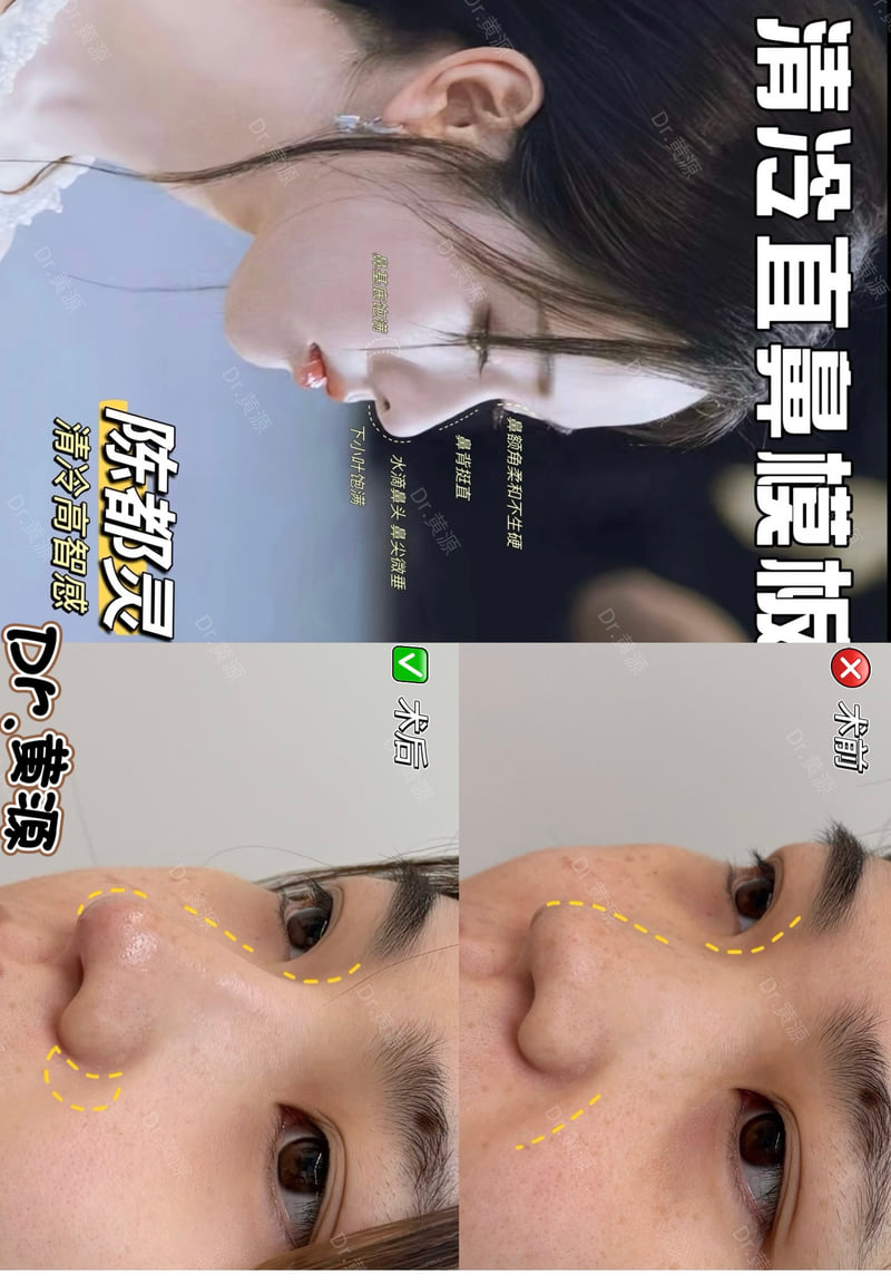 蔡跃波面部提升三件套之价格情况与避坑指南